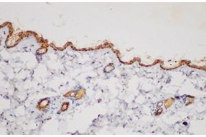 Immunohistochemistry of paraffin-embedded Mouse skin using SERPINB2 Polycloanl Antibody at dilution of 1:200