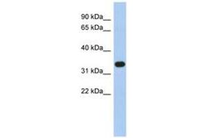 Image no. 1 for anti-Sulfotransferase Family 1B Member 1 (SULT1B1) (N-Term) antibody (ABIN6743488) (SULT1B1 anticorps  (N-Term))