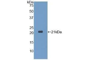 Detection of Recombinant DPT, Human using Polyclonal Antibody to Dermatopontin (DPT) (Dermatopontin anticorps  (AA 26-197))