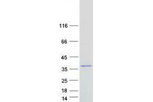 Validation with Western Blot