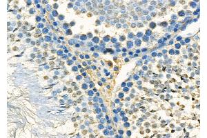 ABIN7093914 and ABIN7097958 at 1/100 staining Rat kidney tissue by IHC-P. (MED12 anticorps  (Internal Region))