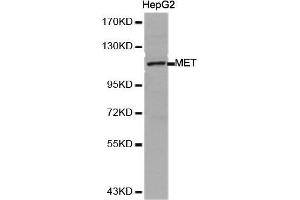 Western Blotting (WB) image for anti-Met Proto-Oncogene (MET) (AA 25-325) antibody (ABIN6213594) (c-MET anticorps  (AA 25-325))