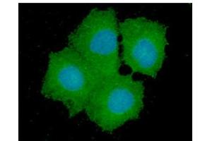 ICC/IF analysis of GPD1L in Hep3B cells line, stained with DAPI (Blue) for nucleus staining and monoclonal anti-human GPD1L antibody (1:100) with goat anti-mouse IgG-Alexa fluor 488 conjugate (Green).