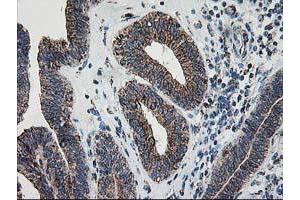 Image no. 3 for anti-Dihydrolipoamide Dehydrogenase (DLD) antibody (ABIN1497845) (DLD anticorps)