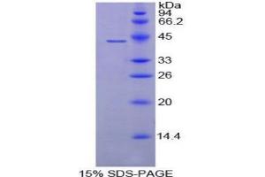 SDS-PAGE analysis of Mouse C8b Protein. (C8B Protéine)