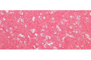 Detection of SYN1 in Human Cortex Tissue using Polyclonal Antibody to Synapsin I (SYN1)