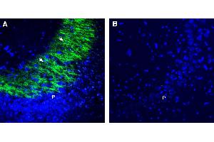 Expression of GPR31 in rat hippocampus.