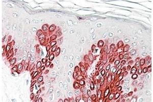 AP23761PU-N SIRT1 antibody staining of paraffin embedded Human Skin at 3. (SIRT1 anticorps  (Internal Region))