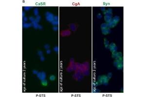 Expression of CaSR by P-STS cells. (Synaptophysin anticorps  (C-Term))