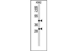 Western blot analysis of DFFA / ICAD Antibody (C-term) in K562 cell line lysates (35ug/lane). (DFFA anticorps  (C-Term))