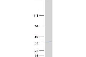 Validation with Western Blot