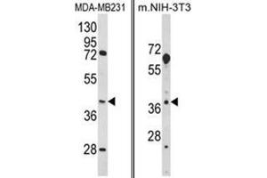 (LEFT) Western blot analysis of HOMER3 Antibody (Center) in MDA-MB231 cell line lysates (35ug/lane). (HOMER3 anticorps  (Middle Region))