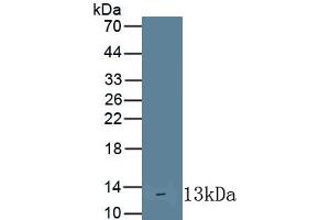 Detection of Recombinant IL10Ra, Human using Monoclonal Antibody to Interleukin 10 Receptor Alpha (IL10Ra) (IL-10RA anticorps  (AA 132-235))