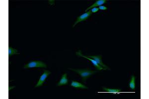 Immunofluorescence of purified MaxPab antibody to RIOK2 on HeLa cell. (RIOK2 anticorps  (AA 1-552))