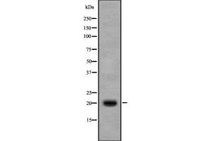 Western blot analysis IL17B using Jurkat whole cell lysates (IL17B anticorps  (Internal Region))