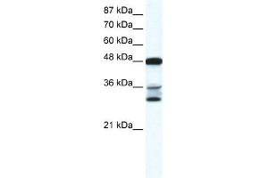 TNFSF10 antibody (70R-10455) used at 0.