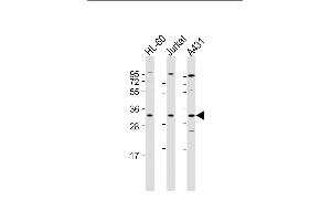 All lanes : Anti-CASP3 Antibody (Center) at 1:2000 dilution Lane 1: HL-60 whole cell lysate Lane 2: Jurkat whole cell lysate Lane 3: A431 whole cell lysate Lysates/proteins at 20 μg per lane. (Caspase 3 anticorps  (AA 60-90))