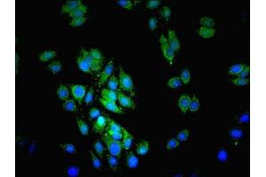 Immunofluorescent analysis of HepG2 cells using ABIN7158764 at dilution of 1:100 and Alexa Fluor 489-congugated AffiniPure Goat Anti-Rabbit IgG(H+L)