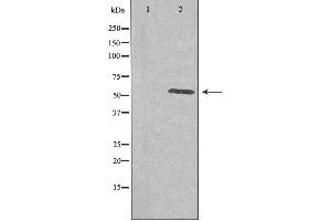 Western blot analysis of extracts from COLO cells using PLK5 antibody. (PLK5 anticorps  (Internal Region))