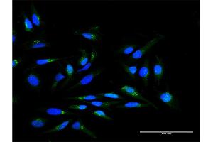 Immunofluorescence of purified MaxPab antibody to SCYL1BP1 on HeLa cell. (GORAB anticorps  (AA 1-246))