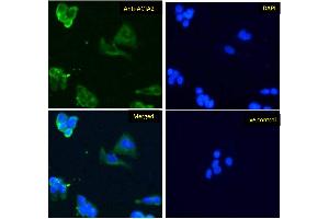 ABIN185271 Immunofluorescence analysis of paraformaldehyde fixed HepG2 cells, permeabilized with 0.