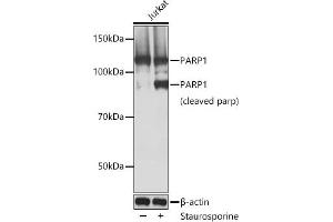 Western blot analysis of extracts of Jurkat cells, using P antibody  at 1:1000 dilution. (PARP1 anticorps)