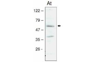 anti-STN8 Kinase antibody