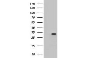 Image no. 2 for anti-Ketohexokinase (KHK) antibody (ABIN1499021) (Ketohexokinase anticorps)