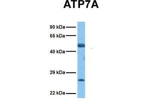 Host:  Rabbit  Target Name:  ATP7A  Sample Tissue:  Human Ovary Tumor  Antibody Dilution:  1. (ATP7A anticorps  (N-Term))