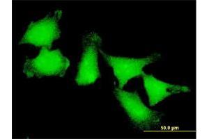 Immunofluorescence of monoclonal antibody to ATOX1 on HeLa cell.