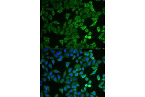 Immunofluorescence analysis of HeLa cell using NPRL2 antibody. (NPRL2 anticorps)