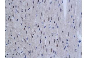 Formalin-fixed and paraffin embedded rat myocardium labeled with Anti-TNFAIP3 Polyclonal Antibody, Unconjugated (ABIN680938) at 1:200 followed by conjugation to the secondary antibody and DAB staining (TNFAIP3 anticorps  (AA 51-150))