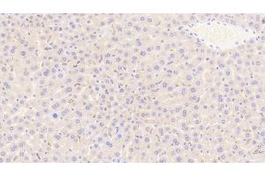 Detection of CD163 in Mouse Liver Tissue using Polyclonal Antibody to Cluster Of Differentiation (CD163)