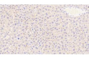 Detection of CD163 in Mouse Liver Tissue using Polyclonal Antibody to Cluster Of Differentiation (CD163) (CD163 anticorps  (AA 697-972))