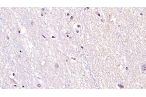Detection of NT3 in Human Cerebrum Tissue using Monoclonal Antibody to Neurotrophin 3 (NT3) (Neurotrophin 3 anticorps  (AA 130-255))
