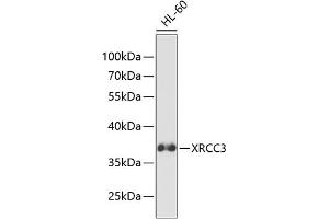 Western blot analysis of extracts of HL-60 cells, using XRCC3 antibody (ABIN3023005, ABIN3023006, ABIN3023007 and ABIN6219342) at 1:1000 dilution.