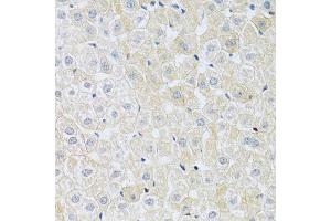 Immunohistochemistry of paraffin-embedded rat liver using SLC4A5 antibody (ABIN5998866) at dilution of 1/100 (40x lens). (NBC4 anticorps)