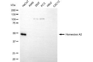 Western blotting analysis using homeobox A2 antibody (ABIN7798988).