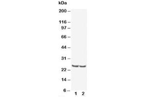 Western blot testing of TIMP4 antibody and Lane 1:  rat kidney (TIMP4 anticorps  (AA 208-224))