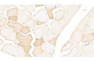 Detection of DMD in Human Skeletal muscle Tissue using Polyclonal Antibody to Dystrophin (DMD)