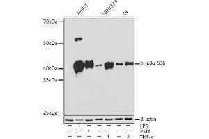 Western blot analysis of extracts of various cell lines, using Phospho-IκBα-S36 Rabbit mAb (ABIN7268992) at 1:1000 dilution.
