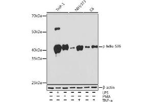 Western blot analysis of extracts of various cell lines, using Phospho-IκBα-S36 Rabbit mAb (ABIN7268992) at 1:1000 dilution. (NFKBIA anticorps  (pSer36))