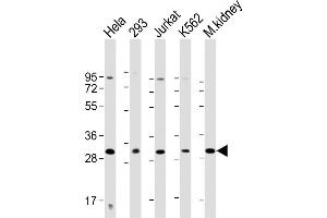 All lanes : Anti-HOXB4 Antibody (Center) at 1:2000 dilution Lane 1: Hela whole cell lysate Lane 2: 293 whole cell lysate Lane 3: Jurkat whole cell lysate Lane 4: K562 whole cell lysate Lane 5: mouse kidney lysate Lysates/proteins at 20 μg per lane. (HOXB4 anticorps  (AA 138-171))