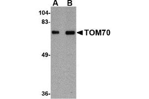 Western Blotting (WB) image for anti-Translocase of Outer Mitochondrial Membrane 70 (TOMM70A) (Middle Region) antibody (ABIN1031140) (TOM70 anticorps  (Middle Region))