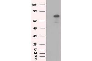 HEK293T cells were transfected with the pCMV6-ENTRY control (Left lane) or pCMV6-ENTRY C17orf28 (Right lane) cDNA for 48 hrs and lysed.