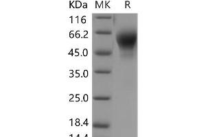 Western Blotting (WB) image for Interleukin 1 Receptor, Type II (IL1R2) (Active) protein (His tag) (ABIN7196346)