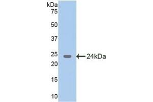Detection of Recombinant GAD2, Rat using Polyclonal Antibody to Glutamate Decarboxylase 2 (GAD2)