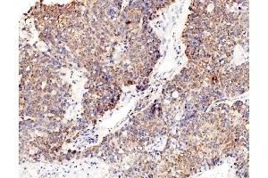 IHC analysis of RPL8 using anti-RPL8 antibody (ABIN7601179).