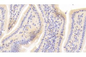 Detection of CYPA in Mouse Colon Tissue using Polyclonal Antibody to Cyclophilin A (CYPA)