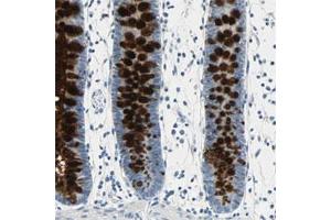 Immunohistochemical staining of human colon shows strong cytoplasmic positivity in glandular cells. (MUC4 anticorps)
